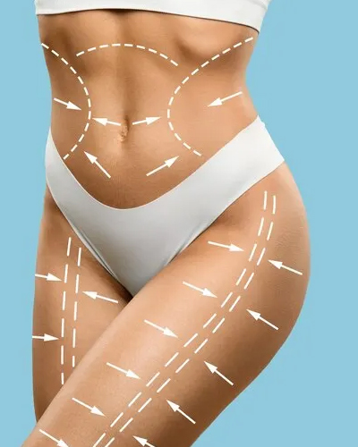 Liposuction at Viswa Plastic Surgery Centre