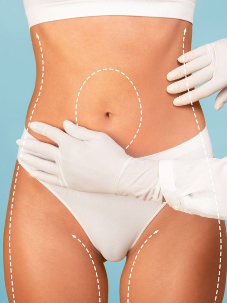 Liposuction at Viswa Clinic
